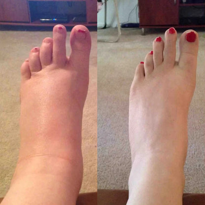 Lymphatic Drainage Drops Curnat