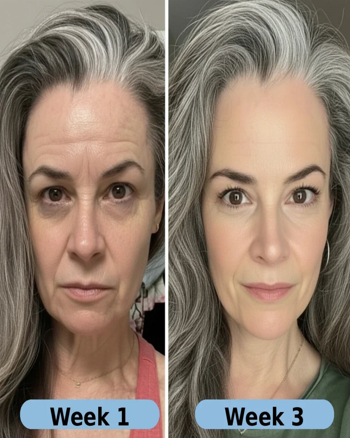 VoluFine® | Korean Collagen Serum for Mature Skin