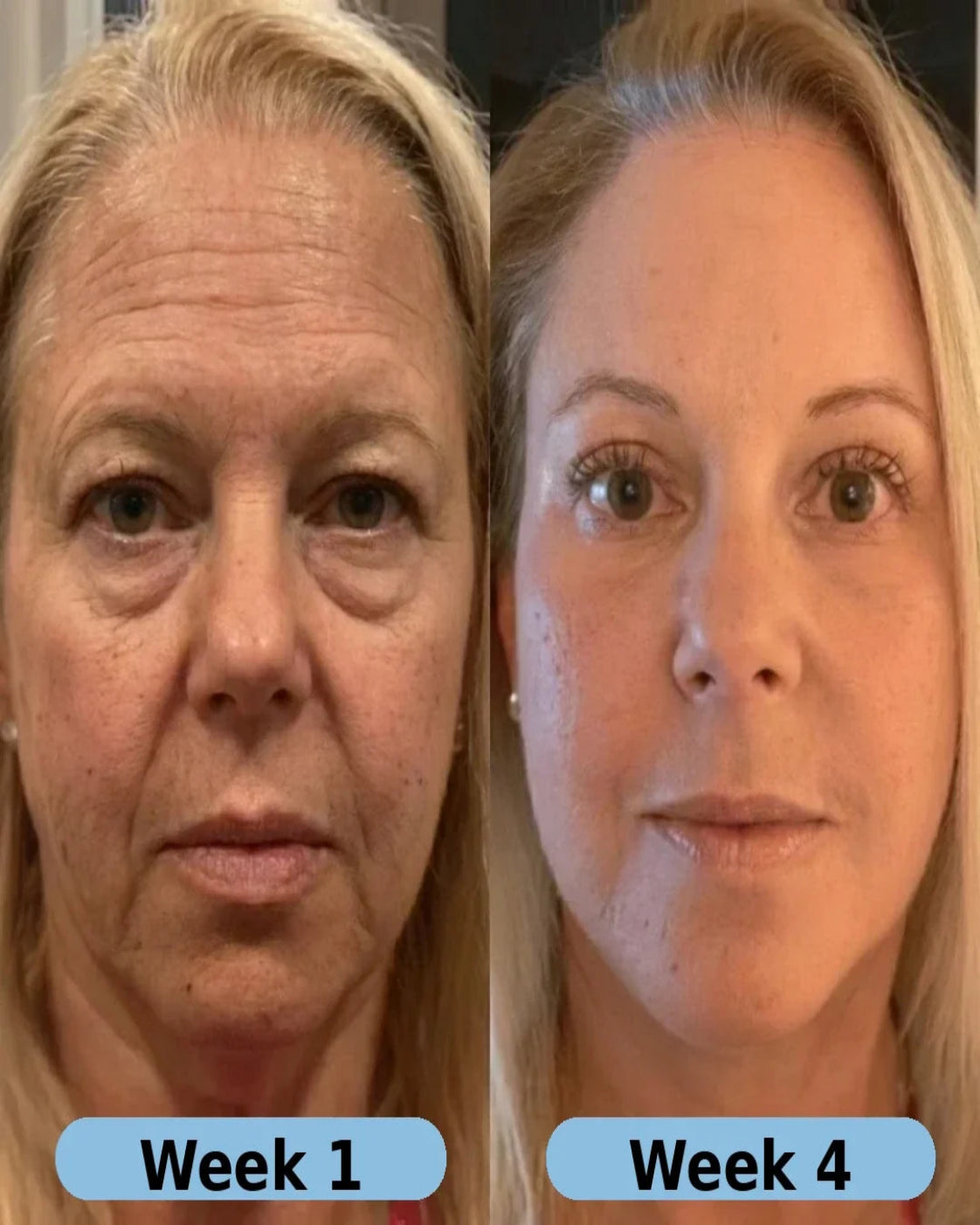 VoluFine® | Korean Collagen Serum for Mature Skin