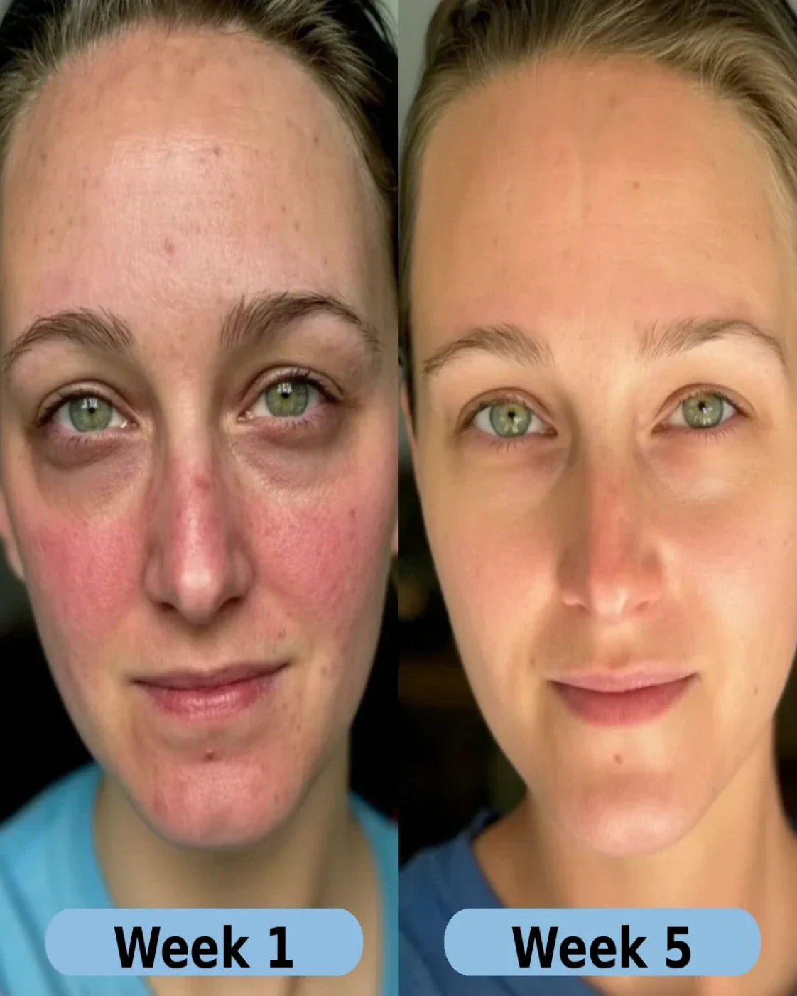 VoluFine® | Korean Collagen Serum for Mature Skin